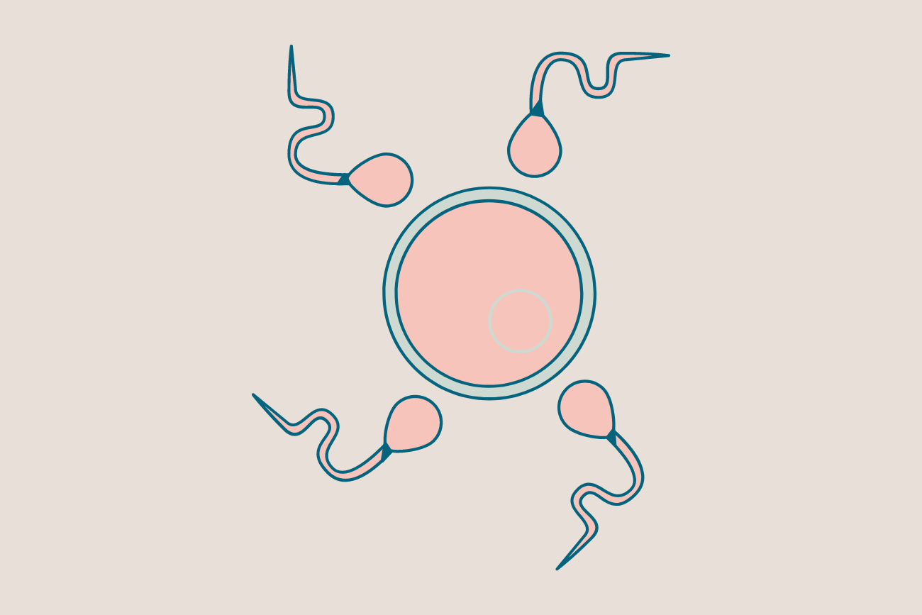 Unexplained Infertility, Immunology, and Recurrent Pregnancy Loss with Dr. Andrea Vidali